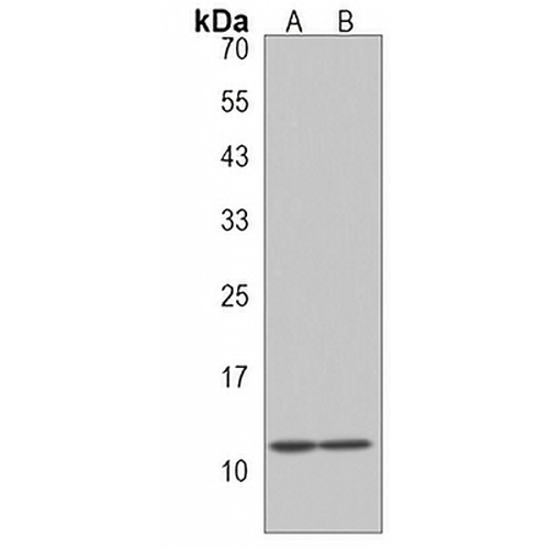 SNRPG Rabbit Polyclonal Antibody