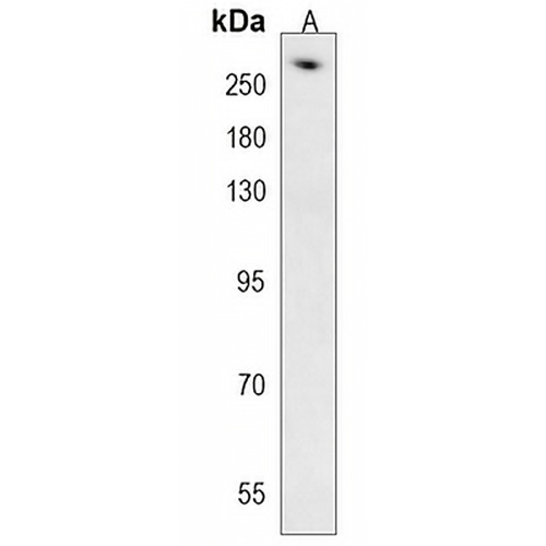 AHCTF1 Rabbit Polyclonal Antibody