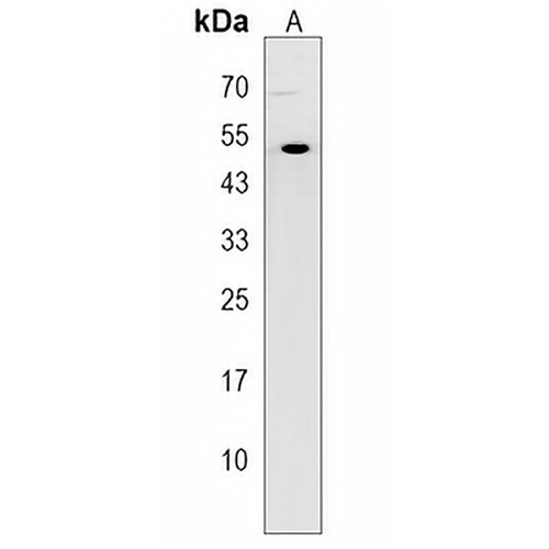 TRIM43B Rabbit Polyclonal Antibody
