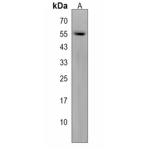 TRIM60 Rabbit Polyclonal Antibody