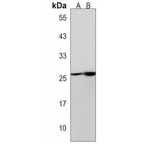CYB5R2 Rabbit Polyclonal Antibody