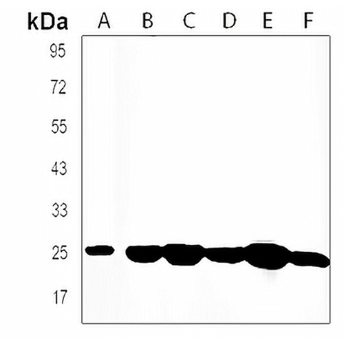 FGF8 Rabbit Polyclonal Antibody