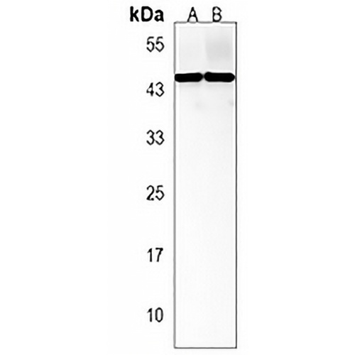 TRAPPC13 Rabbit Polyclonal Antibody