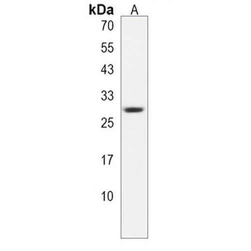 COX11 Rabbit Polyclonal Antibody