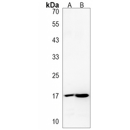 DPPA3 Rabbit Polyclonal Antibody