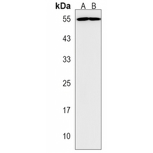 PPP2R2C Rabbit Polyclonal Antibody