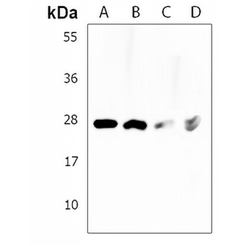 PCGF1 Rabbit Polyclonal Antibody