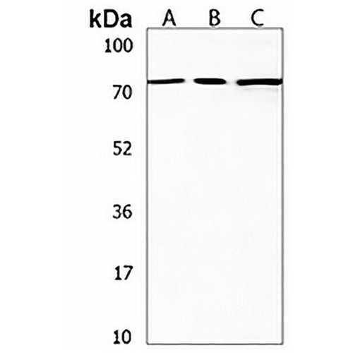 SDAD1 Rabbit Polyclonal Antibody
