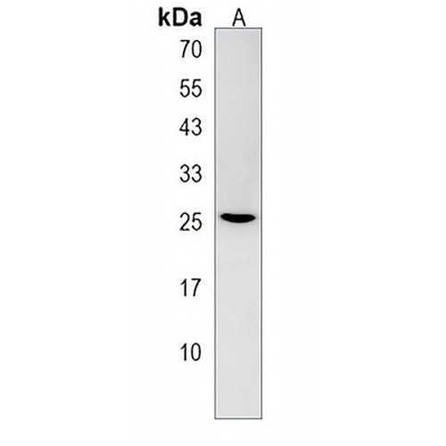 Oligo3 Rabbit Polyclonal Antibody