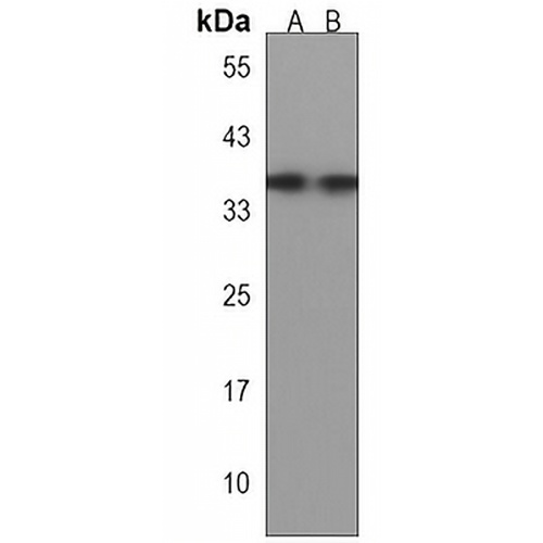 DBX1 Rabbit Polyclonal Antibody