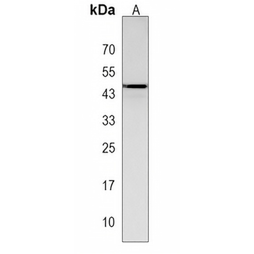 UBTFL1 Rabbit Polyclonal Antibody
