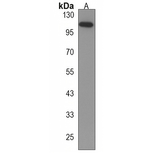 MYOCD Rabbit Polyclonal Antibody
