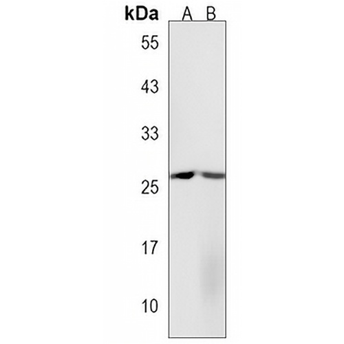 CXCL16 Rabbit Polyclonal Antibody