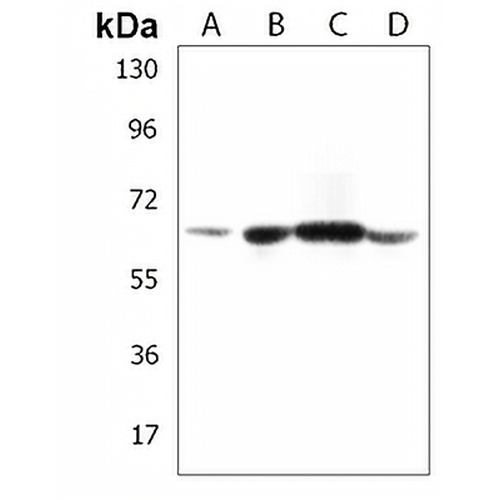 ACSM5 Rabbit Polyclonal Antibody