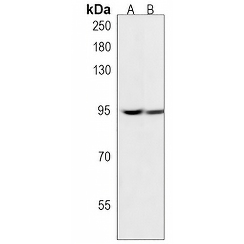 KDM1B Rabbit Polyclonal Antibody