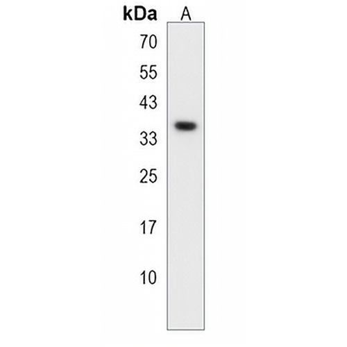 PPAP2A Rabbit Polyclonal Antibody