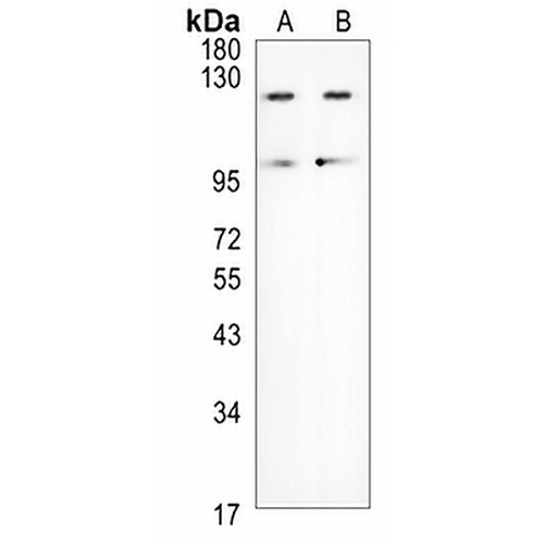 LIFR Rabbit Polyclonal Antibody