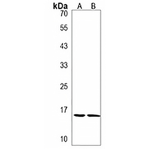 TMEM160 Rabbit Polyclonal Antibody