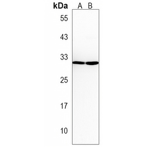 Oligo3 Rabbit Polyclonal Antibody