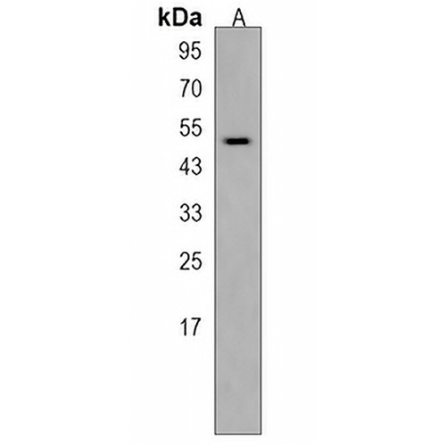 HS6ST2 Rabbit Polyclonal Antibody