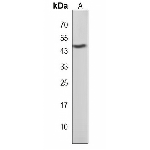 LHX5 Rabbit Polyclonal Antibody