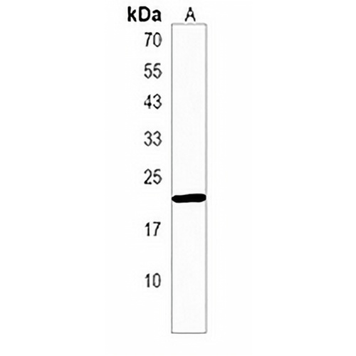 PSF1 Rabbit Polyclonal Antibody