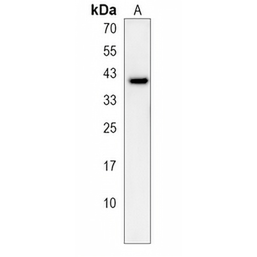 OR5A1 Rabbit Polyclonal Antibody