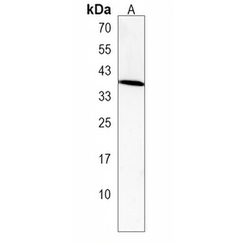 TaR-5 Rabbit Polyclonal Antibody