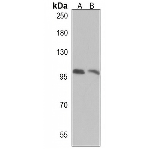 ADAMTS6 Rabbit Polyclonal Antibody