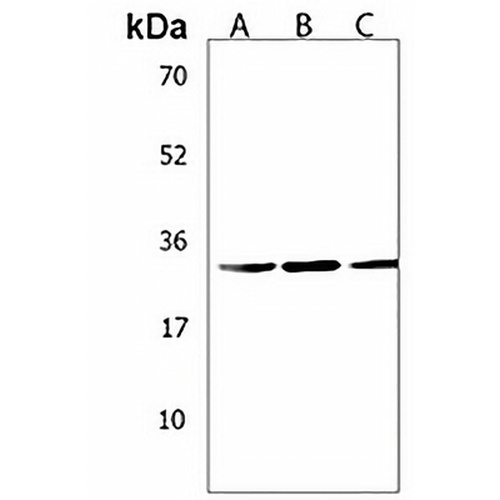 PYCRL Rabbit Polyclonal Antibody