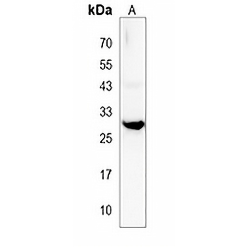 RYBP Rabbit Polyclonal Antibody