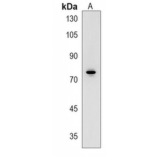 SPATA13 Rabbit Polyclonal Antibody
