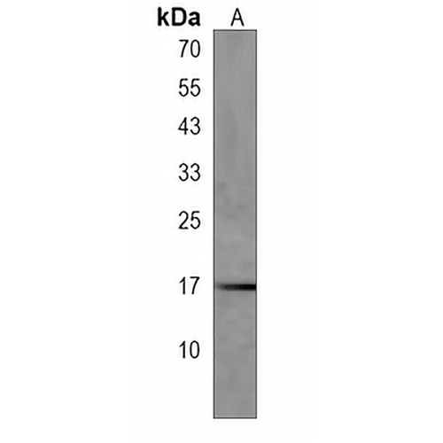 C1orf95 Rabbit Polyclonal Antibody