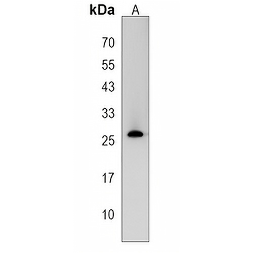 CRISPLD2 Rabbit Polyclonal Antibody