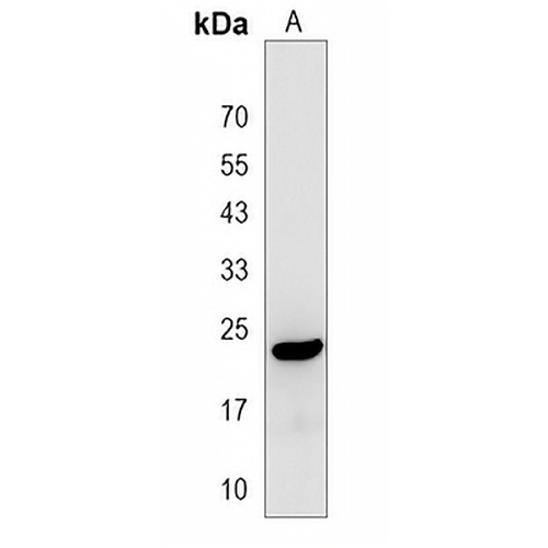 RBM24 Rabbit Polyclonal Antibody