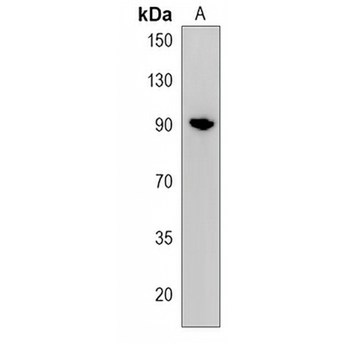 CPEB4 Rabbit Polyclonal Antibody
