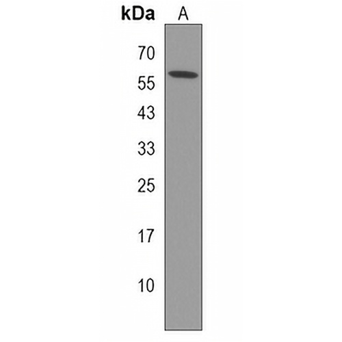 TRIM50 Rabbit Polyclonal Antibody