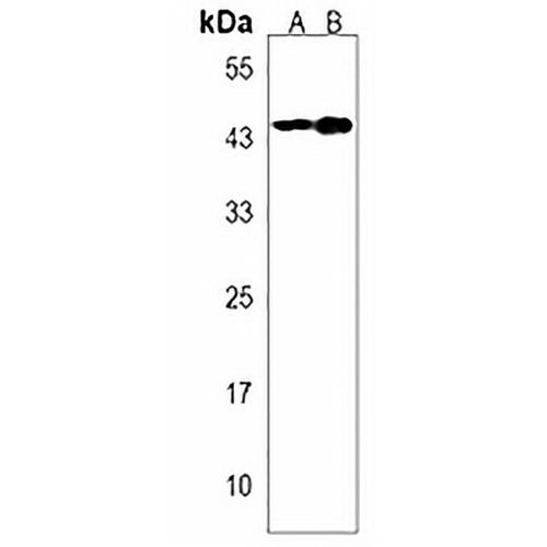Calcitonin Receptor Rabbit Polyclonal Antibody