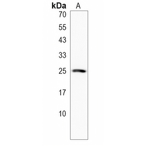 LHFPL3 Rabbit Polyclonal Antibody