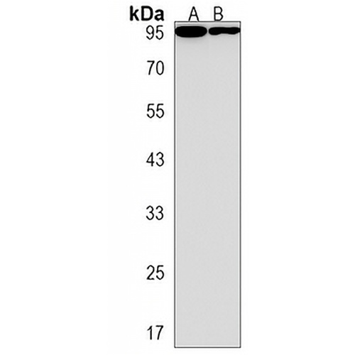 AFTPH Rabbit Polyclonal Antibody