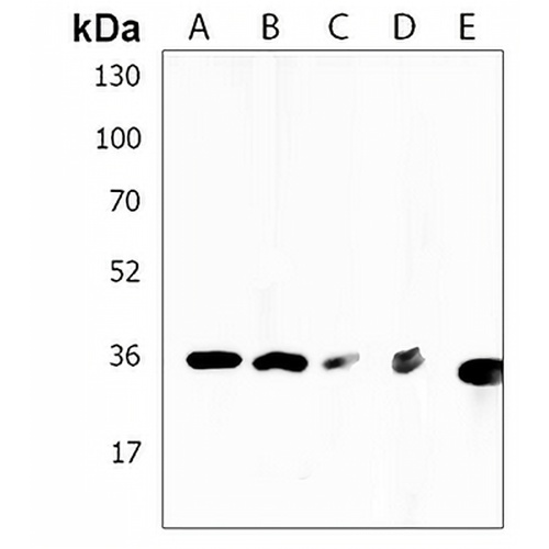 RCN3 Rabbit Polyclonal Antibody