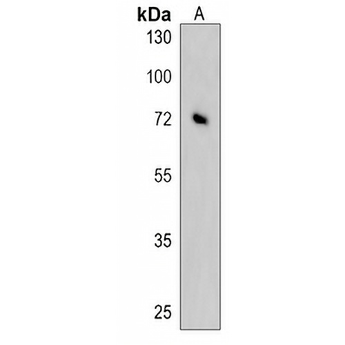 KLHL6 Rabbit Polyclonal Antibody