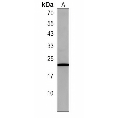 LOH12CR1 Rabbit Polyclonal Antibody