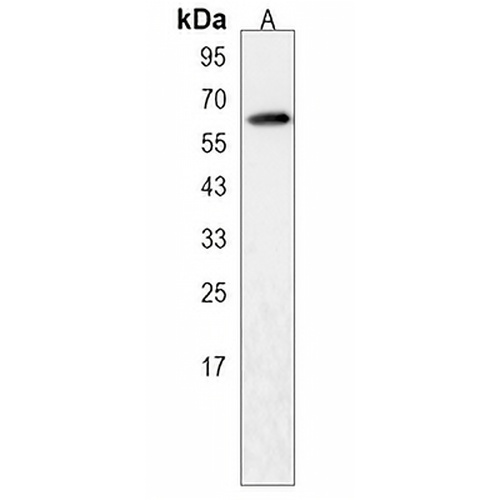 RTKN2 Rabbit Polyclonal Antibody