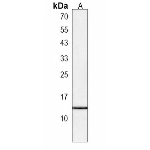 VKORC1 Rabbit Polyclonal Antibody