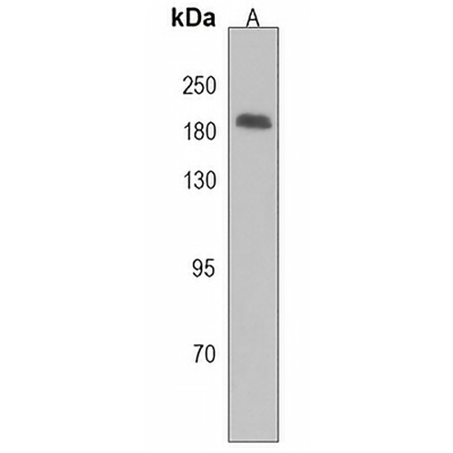 Adenylate Cyclase 10 Rabbit Polyclonal Antibody