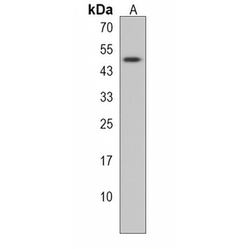 DDI2 Rabbit Polyclonal Antibody