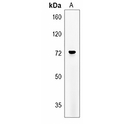 MMP24 Rabbit Polyclonal Antibody