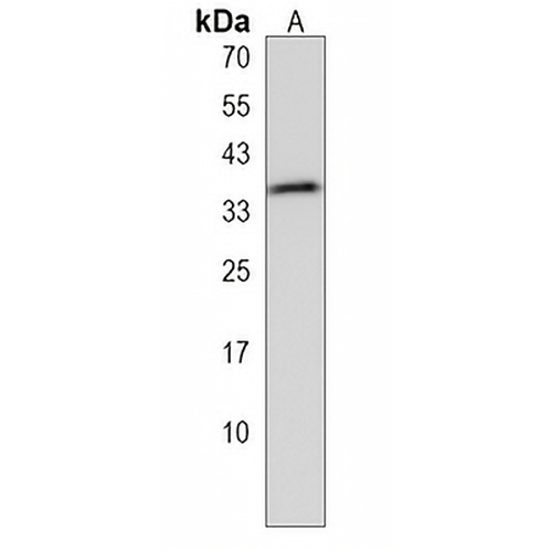 DSCR3 Rabbit Polyclonal Antibody