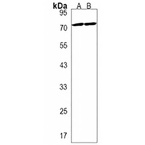 ZBTB7B Rabbit Polyclonal Antibody